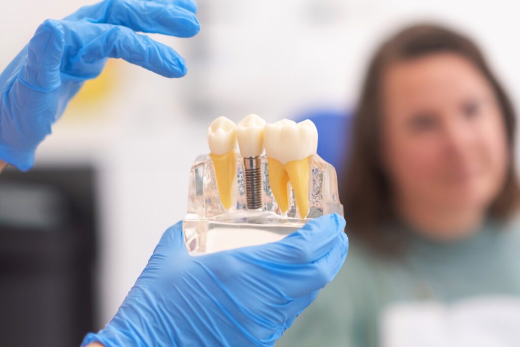augmentare-tesut-keratinizat