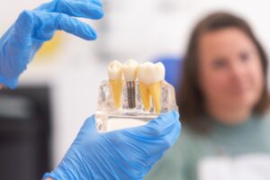 augmentare-tesut-keratinizat
