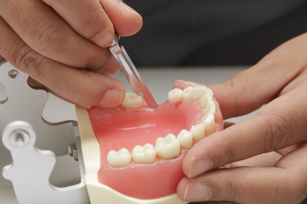 grefa-dentinara