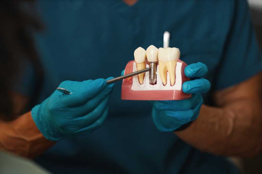mucozita peri-implantara