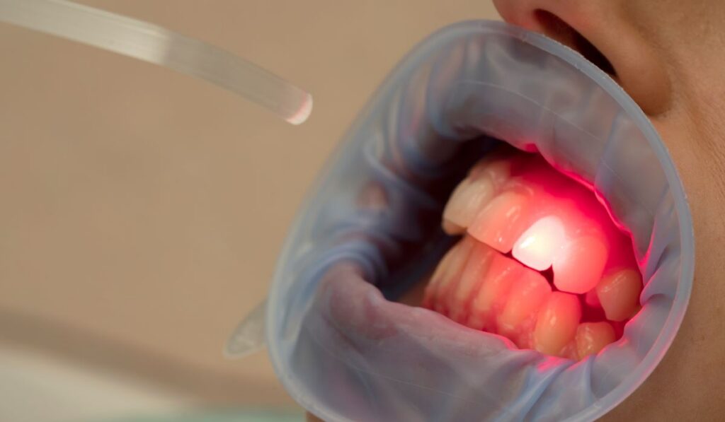 pacient stomatologie in timpul aplicarii terapiei fotodinamice dentare